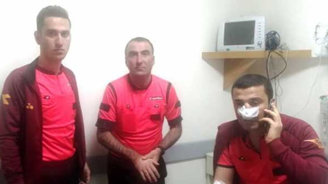 Çorum'da 1. Amatör Küme maçında saldırıya uğrayan hakemin burnu kırıldı