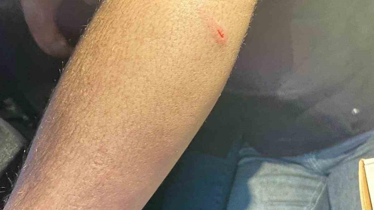 Siirt’te oto sanayisinde sokak köpeklerinin saldırdığı genç yaralandı
