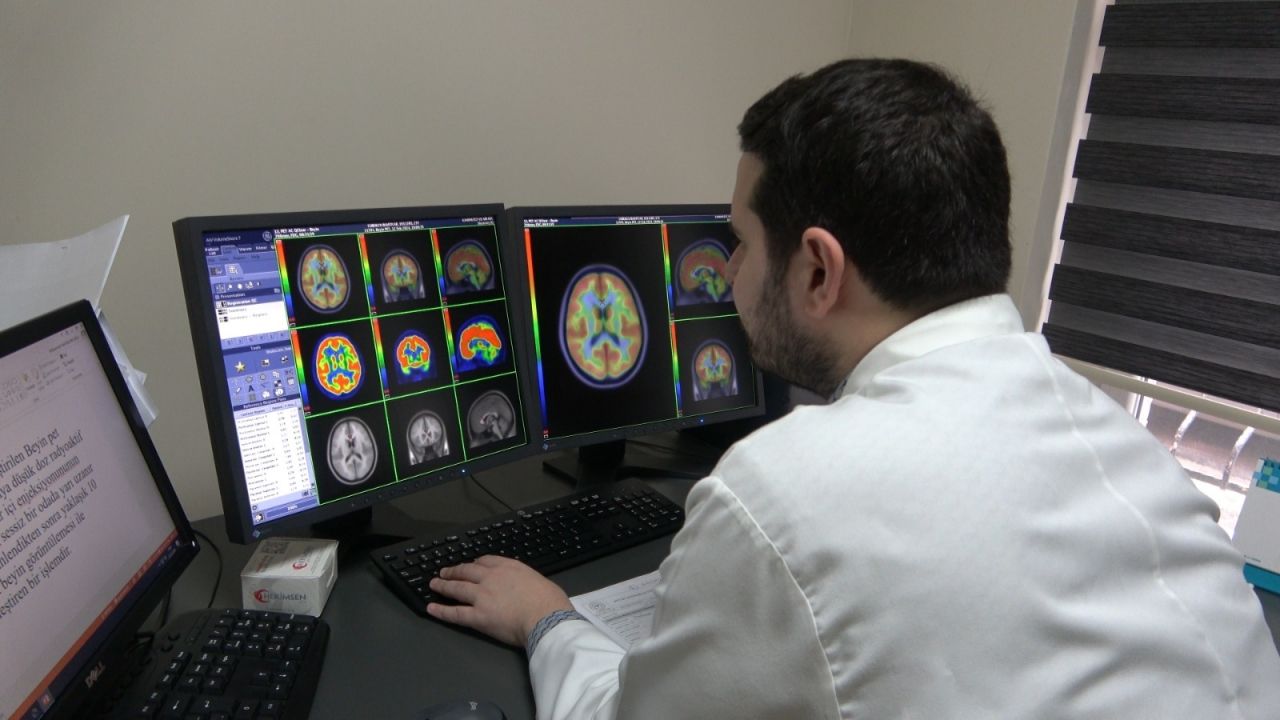 Trabzon'da beyin PET-BT tetkikiyle Alzheimer ve epilepsi erken teşhis edilecek
