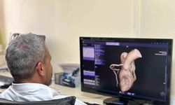 Diyarbakır’da kalp hastalıkları Kardiyak MR ile etkili ve hızlı teşhis ediliyor