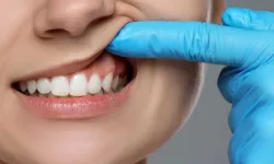 Eğer diş etiniz çekiliyorsa dikkat! Çünkü kemik de eriyor demektir