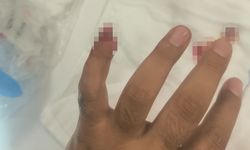 Yasaklı maddeyle yakalandı, polisin parmağını ısırarak kopardı