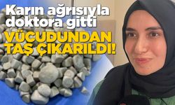 Vücudundan 287 adet taş çıkarıldı