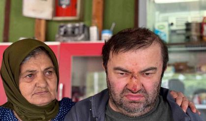 Engelli vatandaş acımasızca darp edildi