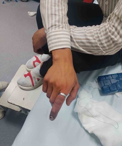 Parmağında sıkışan yüzük ekipleri alarma geçirdi