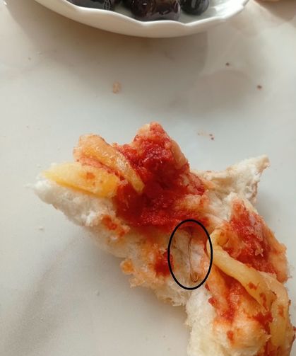 Yediği ekmeğin içinden çatal iğne çıktı