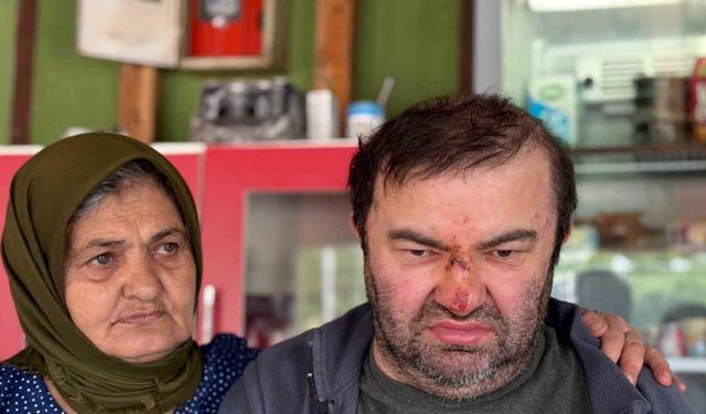 Engelli vatandaş acımasızca darp edildi