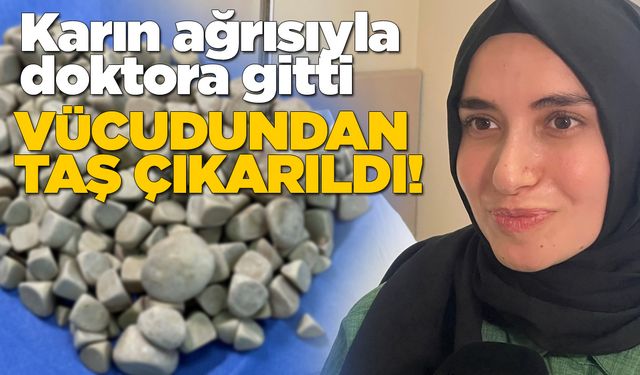 Vücudundan 287 adet taş çıkarıldı
